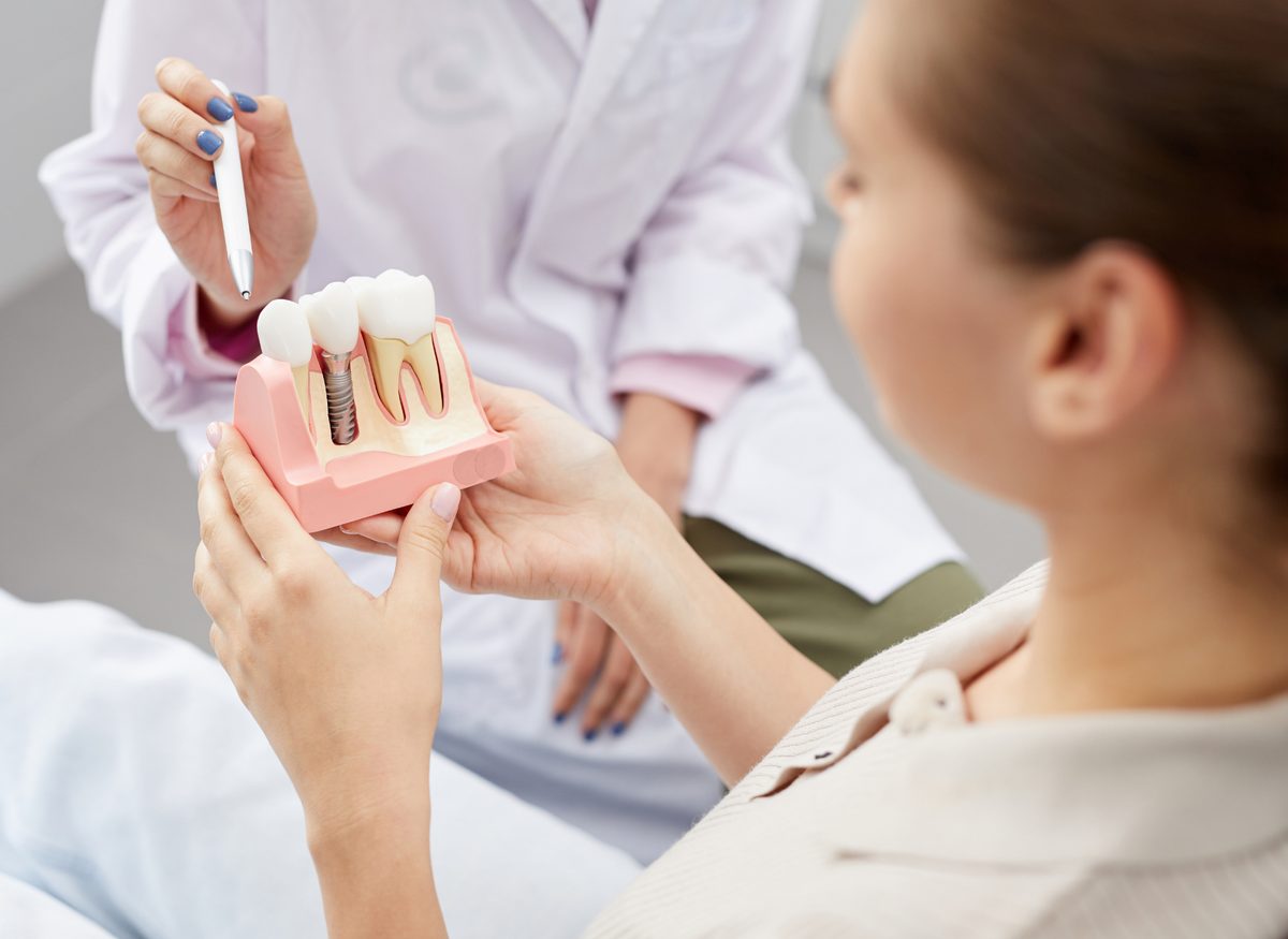 All-on-X Implants at Farzad Dental