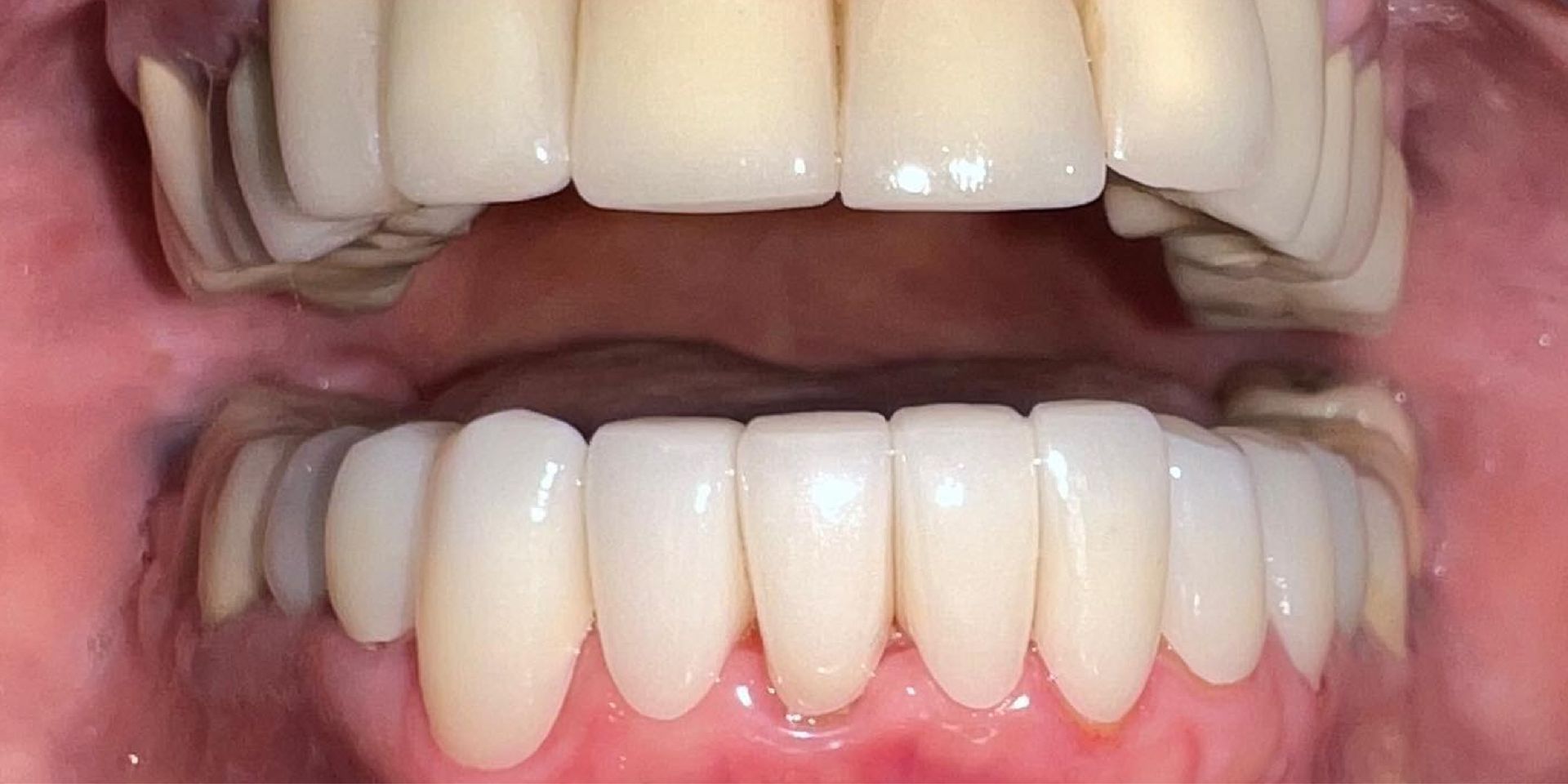 After treatment at Farzad Dental