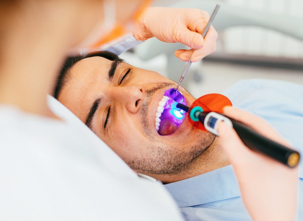 Dental Sealants at Farzad Dental