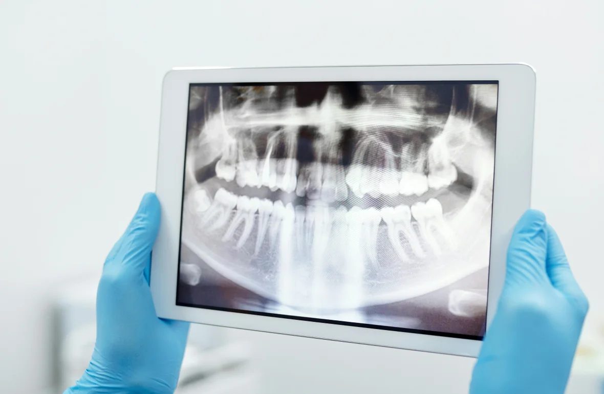Orthodontics dentistry at Farzad Dental