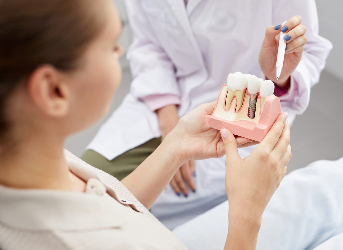 Single Tooth Implants at Farzad Dental