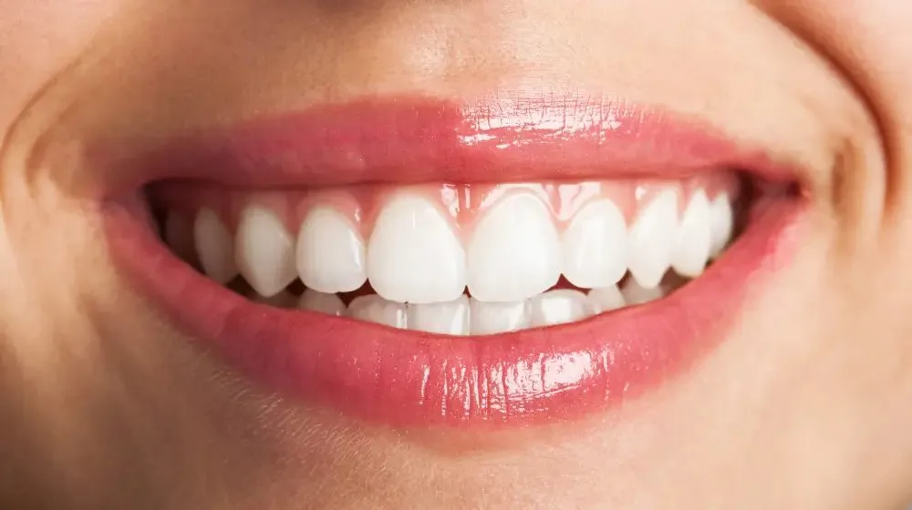 Smile after treatment