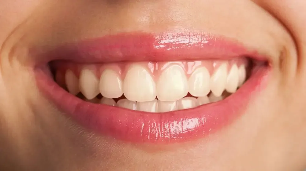 Smile before treatment