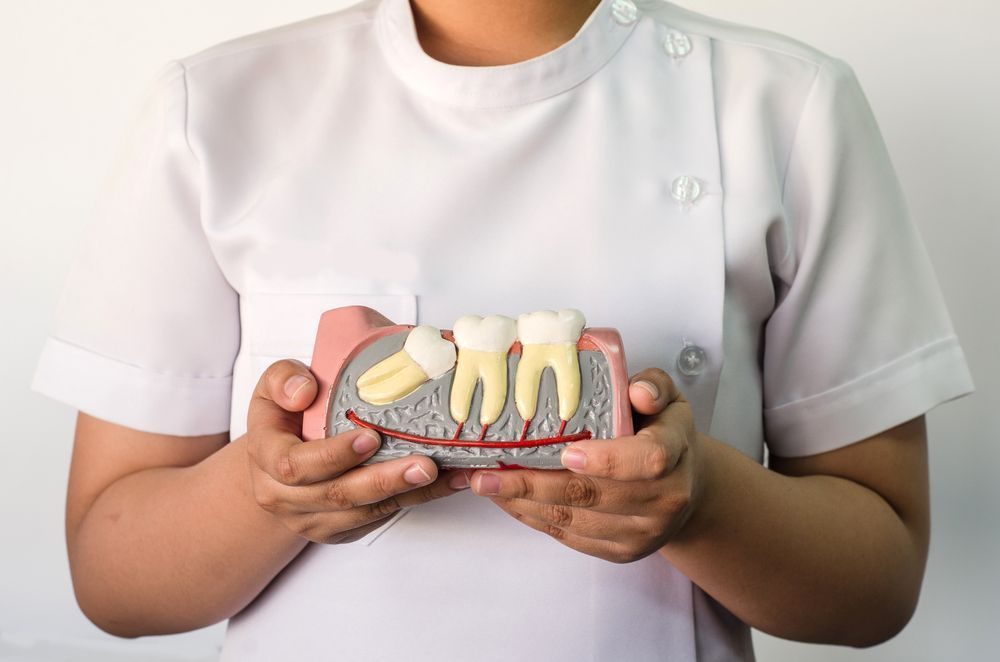 Wisdom Teeth Removal at Farzad Dental